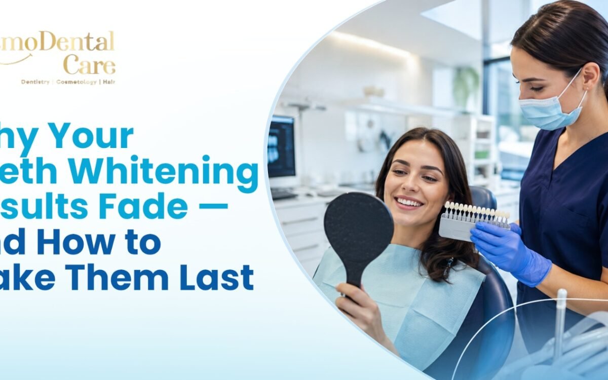 why-teeth-whitening-results-fade