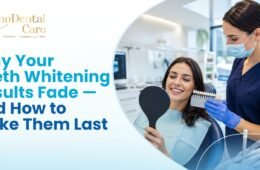 Why Do Teeth Whitening Results Fade, and How to Stop It