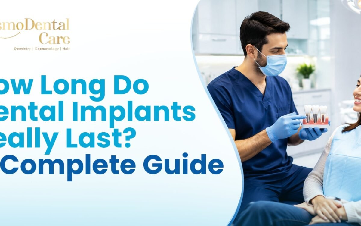 : how long do dental implants last