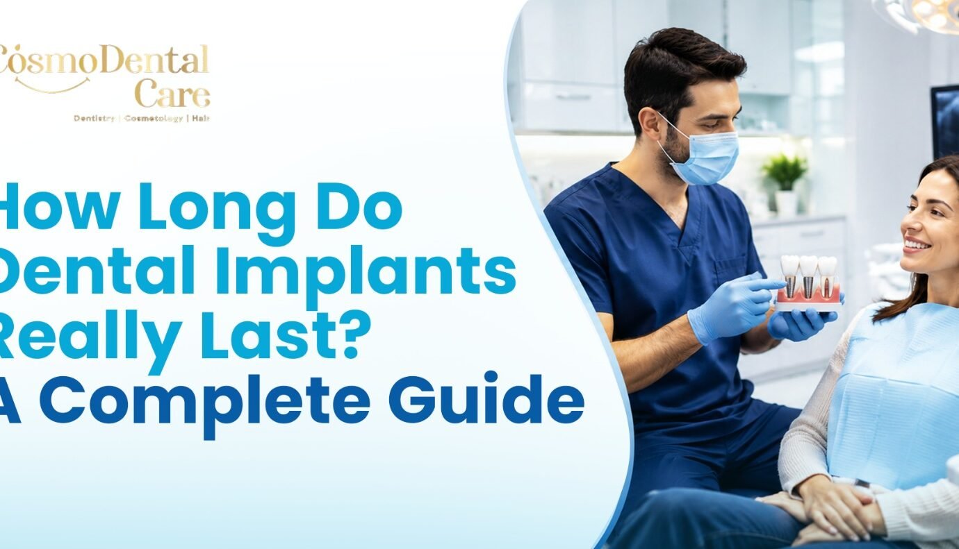: how long do dental implants last