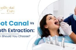 Root Canal vs Tooth Extraction: Which Should You Choose?