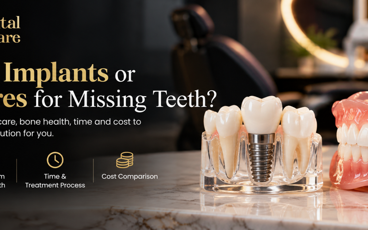 dental-implants-vs-dentures-missing-teeth